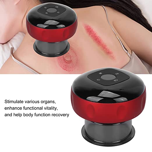 Intelligent breathing cupping massage instrument™